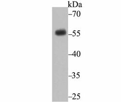 CD27/TNFRSF7 Antibody (JB40-98), Novus Biologicals 100 &mu;L | Buy Online | Novus Biologicals | Fisher Scientific